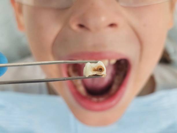 Best Emergency Gum Treatment in Celoron, NY